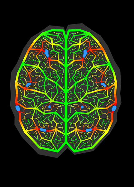 A graphic representation of a road network in the shape of a brain with blockages shown in blue surrounded by red areas representing congestion