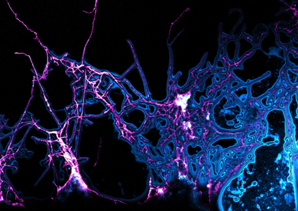 A microscope image of Actinomycete bacteria