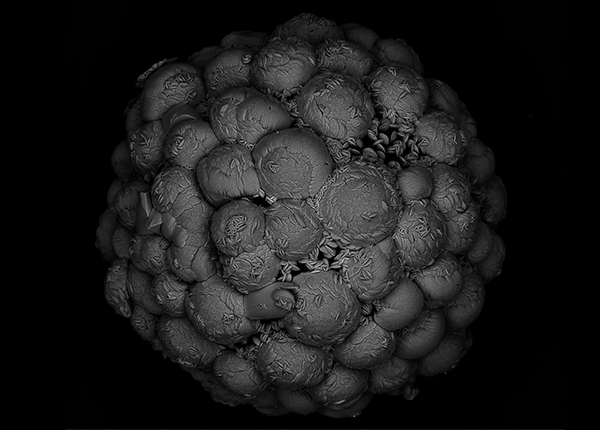 A black and white 3D microscope image of a sphere made up of lots of little spheres covered in little specks resembling seeds