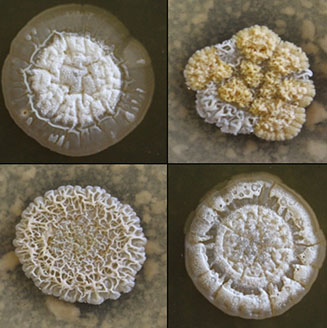 Microscope images of soil bacteria that resemble little sponges