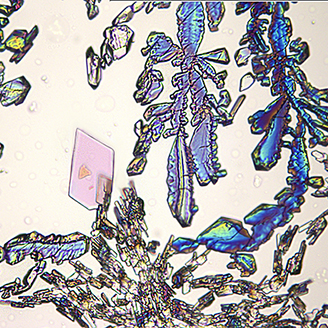 A microscope image showing crystallisation of the drug mefenamic acid