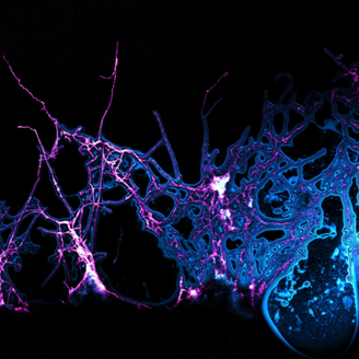 A microscope image of Actinomycete bacteria