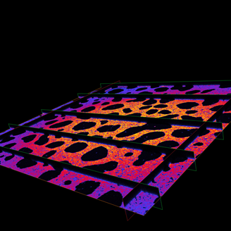 A 3D microscopy image of a damaged biofilm