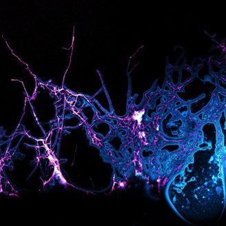 A microscope image of Actinomycete bacteria