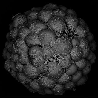 A black and white 3D microscope image of a sphere made up of lots of little spheres covered in little specks resembling seeds