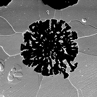 A black and white microscope image of  virus-like black particle