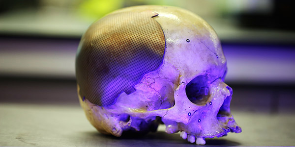 Advanced Forming Research Centre, research, demonstration with skull