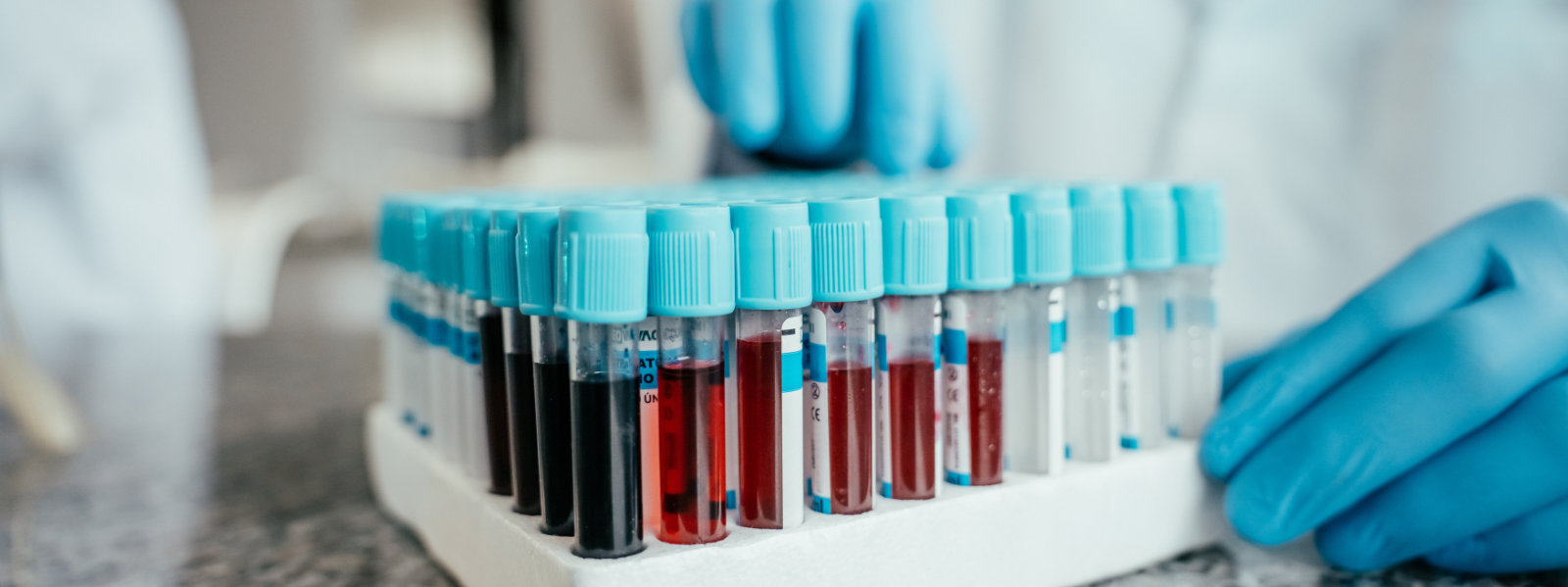 Samples of blood in a lab