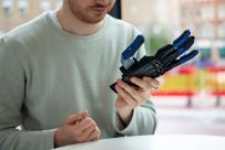 The Metacarpal Prosthetic hand