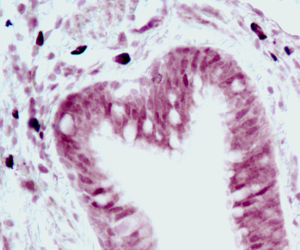 Close of lung tissue showing heart shape