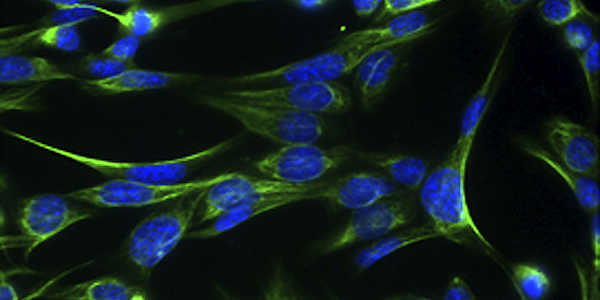 Cells shown with blue nuclei 