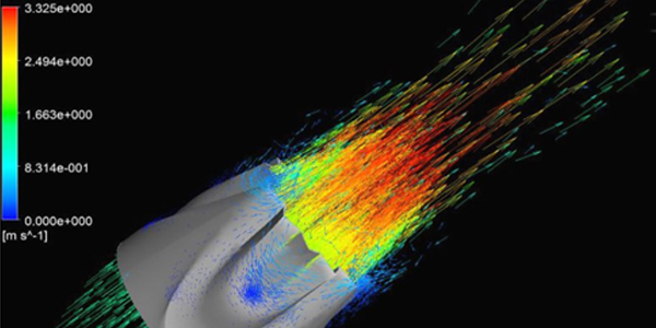 Computerized modelling of a heart valve 