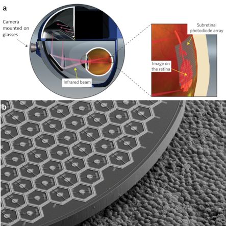 Microscope image of photovoltaic retinal implant Microscope image of photovoltaic retinal implant