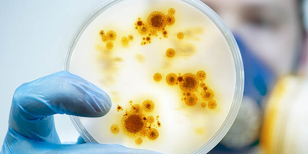 Scientist holding petri dish. 