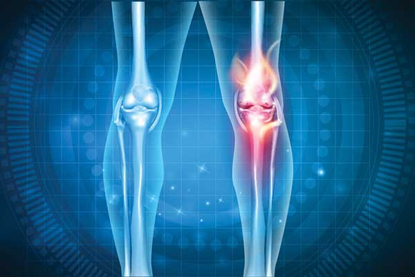 Abstract computer illustration of a knee joint.