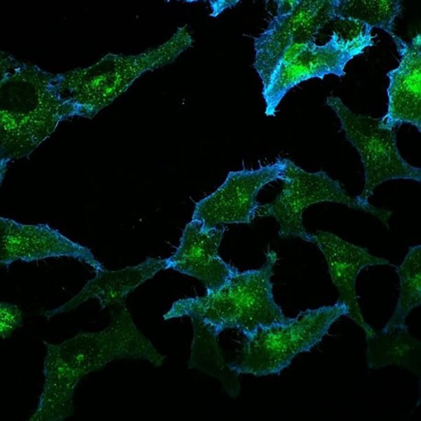 Glucose transporters inside a cell.