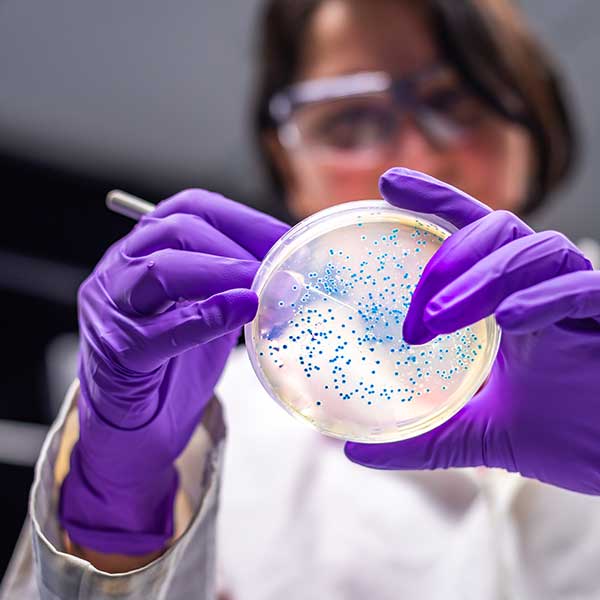 Researcher performing examination of bacterial culture plate.