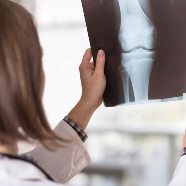 doctor looking at the x-ray picture of knee injury.