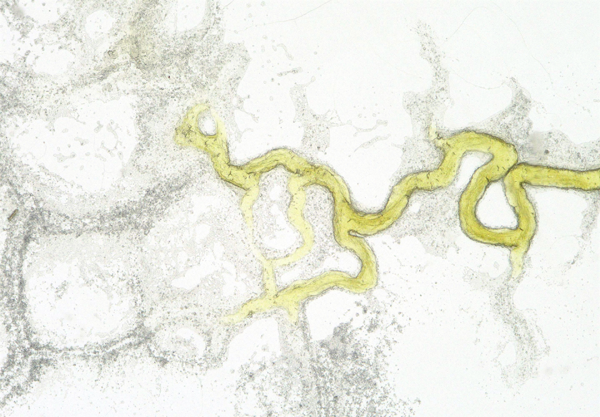 A collection of single cells forming a slime mould