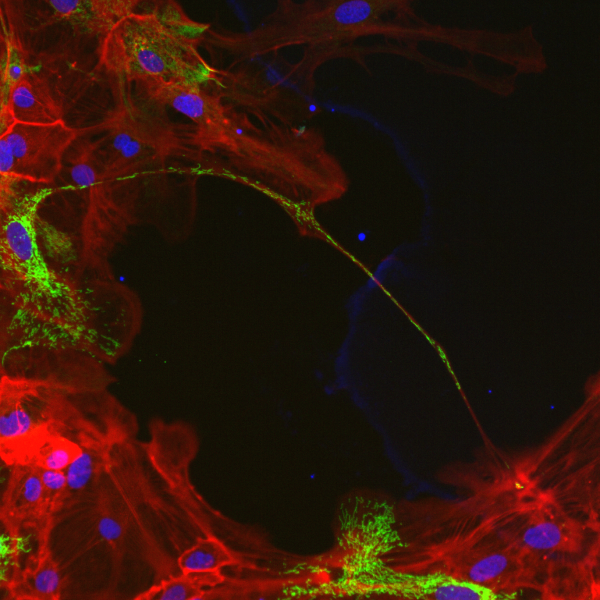Green mitochondria dots – the energy hubs of cells – appearing to travel along a thin cellular connection highlighted by the red cell skeleton
