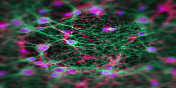 A neural network as seen in lab conditions
