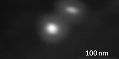 Scanning electron transmission micrograph obtained from gold nanoparticles embedded in amorphous silica capsules