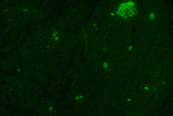 Specs of green light that are the tiny plastic particles.