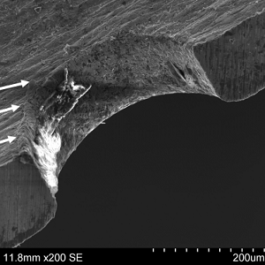 Scanning Electron Microscope showing roughness on inner side of aspiration aperture